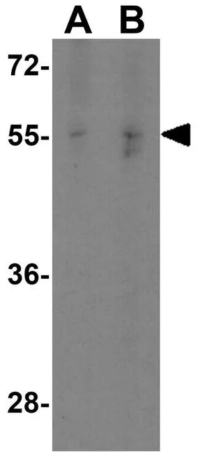 WB analysis of HepG2 cell lysate using GTX31907 SPNS1 antibody. Working concentration : (A) 1 and (B) 2 microg/ml