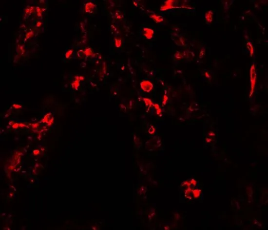 IHC-P analysis of human lung tissue using GTX31909 SUZ12 antibody. Working concentration : 20 microg/ml