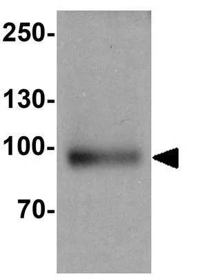 WB analysis of human liver tissue lysate using GTX31909 SUZ12 antibody. Working concentration : 1 microg/ml