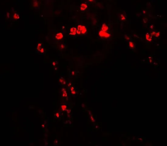 IHC-P analysis of human lung tissue using GTX31912 HMGB1 antibody. Working concentration : 20 microg/ml