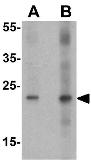 WB analysis of human brain tissue lysate using GTX31912 HMGB1 antibody. Working concentration : (A) 1 and (B) 2 microg/ml