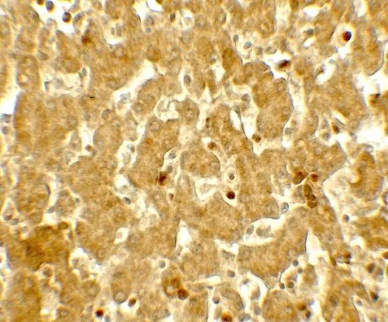 IHC-P analysis of human liver tissue using GTX31919 IFIT3 antibody. Working concentration : 5 microg/ml IHC-P analysis of human liver tissue using GTX31919 IFIT3 antibody. Working concentration : 5 microg/ml