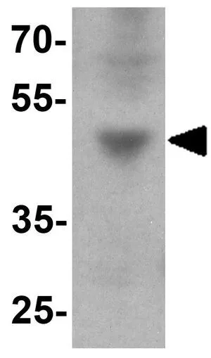 WB analysis of HepG2 cell lysate using GTX31919 IFIT3 antibody. Working concentration : 1 microg/ml