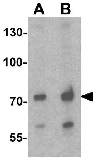WB analysis of 293 cell lysate using GTX31920 ATMIN antibody. Working concentration : (A) 1 and (B) 2 microg/ml WB analysis of 293 cell lysate using GTX31920 ATMIN antibody. Working concentration : (A) 1 and (B) 2 microg/ml