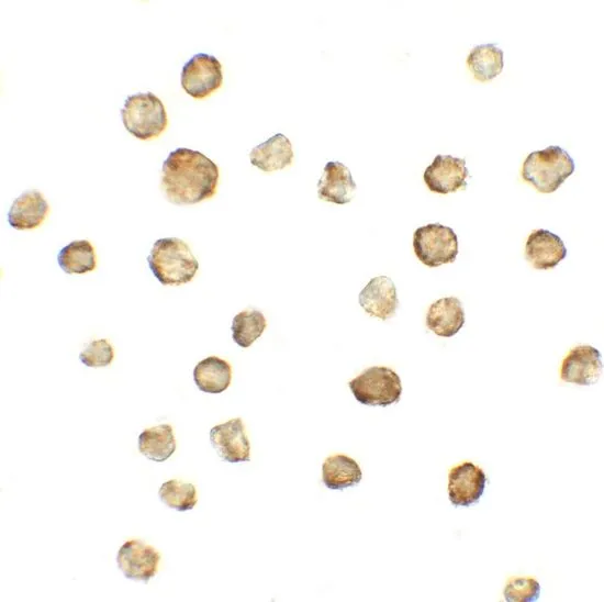 ICC/IF analysis of A431 cells using GTX31920 ATMIN antibody. Working concentration : 5 microg/ml