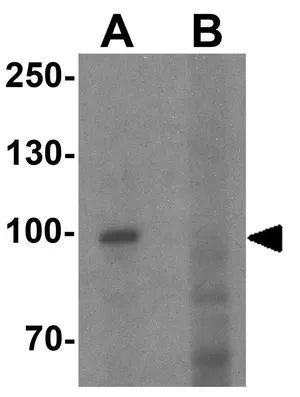 WB analysis of human heart tissue lysate in (A) the absence and (B) the presence of blocking peptide using GTX31921 PGC1 alpha antibody. Working concentration : 1 microg/ml