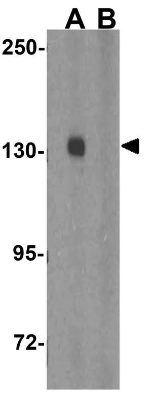 WB analysis of human skeletal muscle tissue lysate in (A) the absence and (B) the presence of blocking peptide using GTX31921 PGC1 alpha antibody. Working concentration : 1 microg/ml