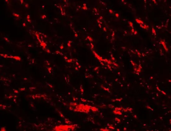 IHC-P analysis of rat brain tissue using GTX31923 MFN2 antibody. Working concentration : 20 microg/ml