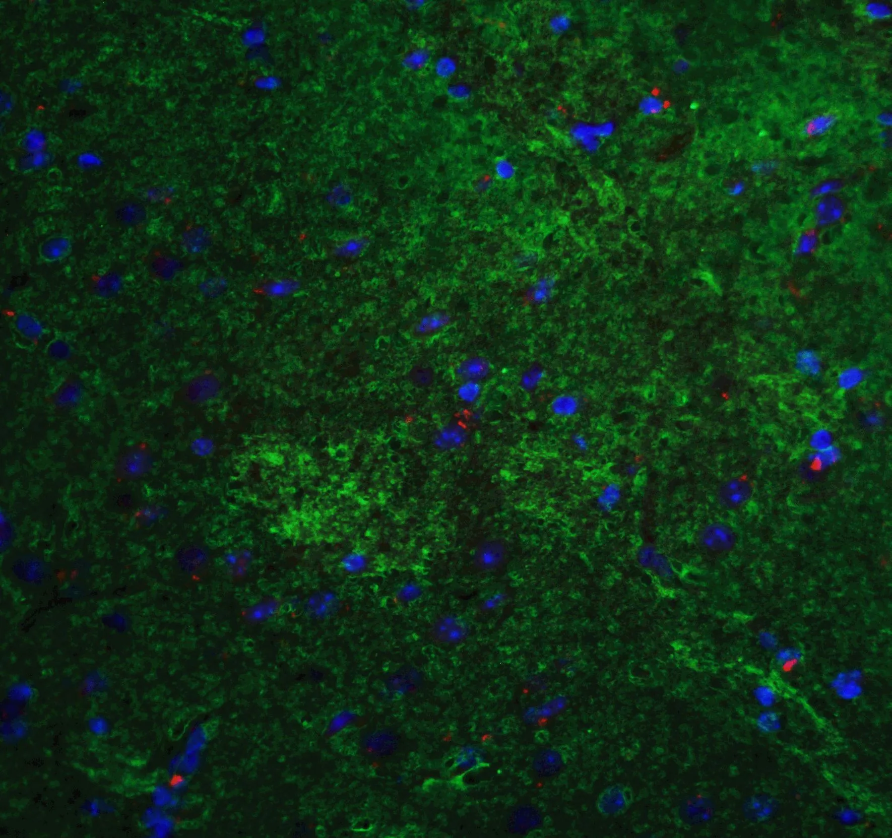 IHC-P analysis of mouse brain tissue using GTX31923 MFN2 antibody. Green : Primary antibody Red : Actin Blue : DAPI Dilution : 20 microg/ml