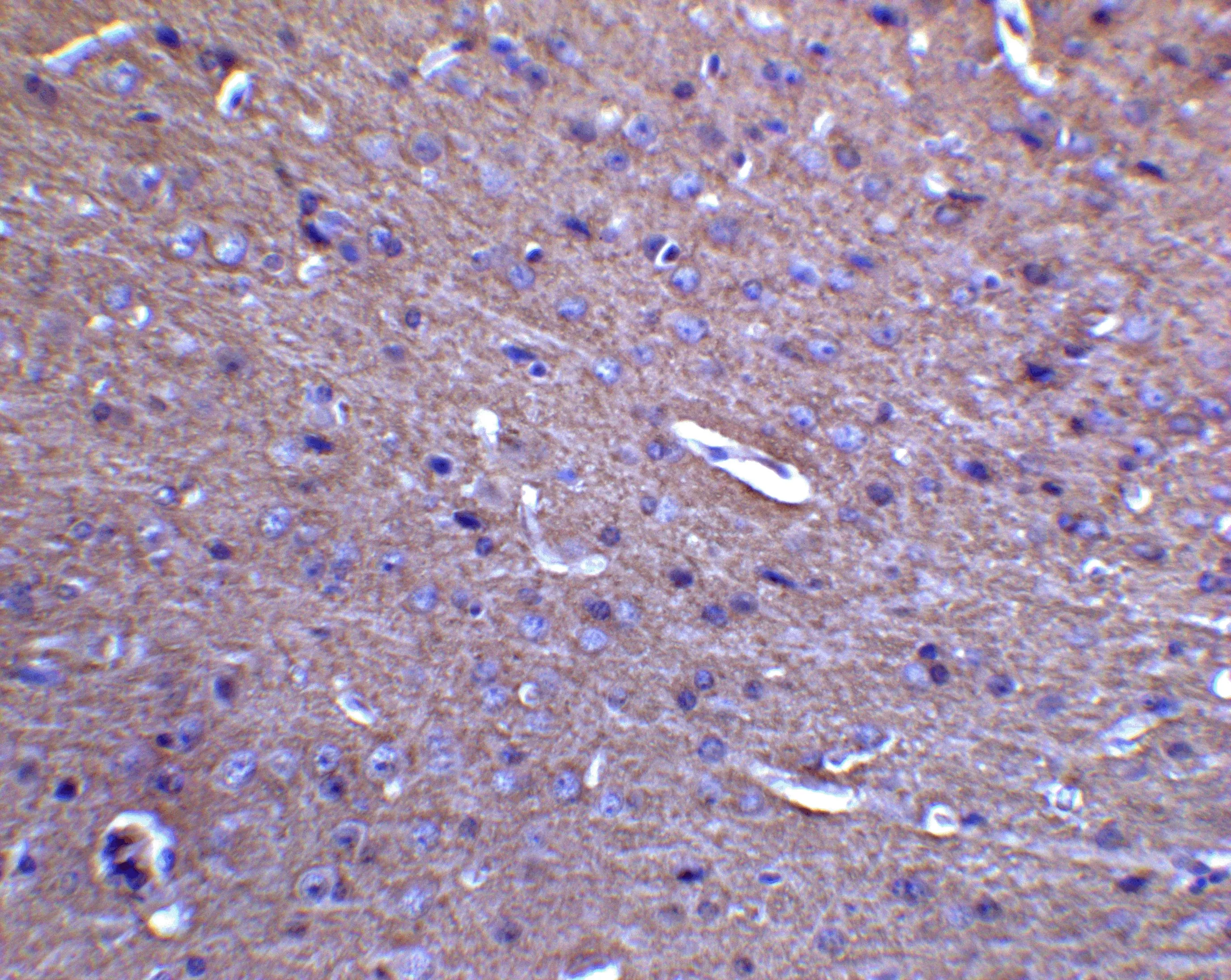 IHC-P analysis of mouse brain tissue using GTX31923 MFN2 antibody. Dilution : 5 microg/ml