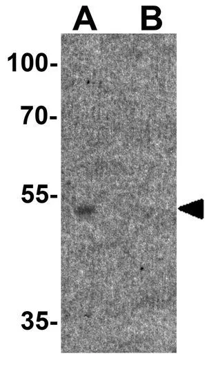 WB analysis of human brain tissue lysate in (A) the absence and (B) the presence of blocking peptide using GTX31924 HDAC1 antibody. Working concentration : 1microg/ml WB analysis of human brain tissue lysate in (A) the absence and (B) the presence of blocking peptide using GTX31924 HDAC1 antibody. Working concentration : 1microg/ml