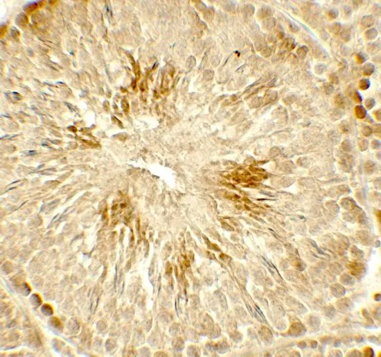IHC-P analysis of rat testis tissue using GTX31925 HDAC2 antibody. Working concentration : 5 microg/ml IHC-P analysis of rat testis tissue using GTX31925 HDAC2 antibody. Working concentration : 5 microg/ml