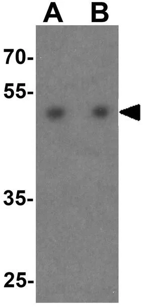 WB analysis of HeLa cell lysate using GTX31925 HDAC2 antibody. Working concentration : (A) 0.5 and (B) 1 microg/ml
