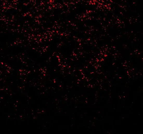 IHC-P analysis of rat brain tissue using GTX31928 alpha Synuclein antibody. Working concentration : 20 microg/ml