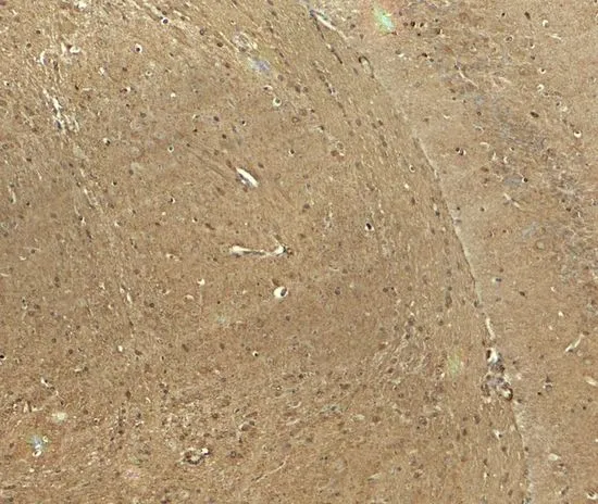 IHC-P analysis of mouse brain tissue using GTX31935 CADM3 antibody. Working concentration : 5 microg/ml IHC-P analysis of mouse brain tissue using GTX31935 CADM3 antibody. Working concentration : 5 microg/ml