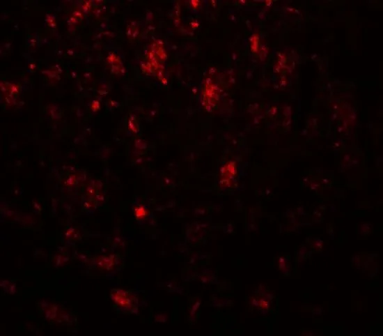 IHC-P analysis of mouse brain tissue using GTX31935 CADM3 antibody. Working concentration : 20 microg/ml