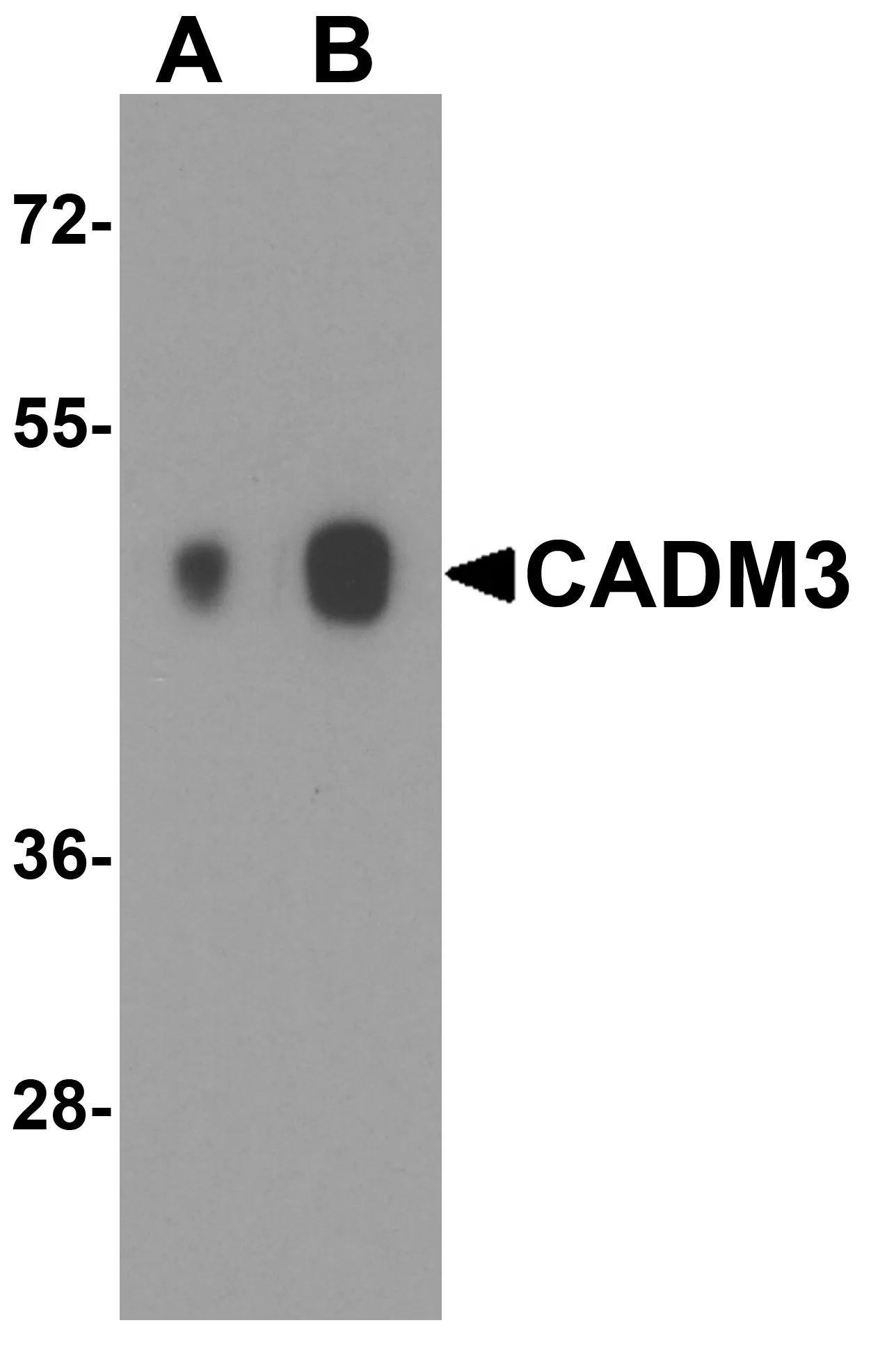 WB analysis of human brain tissue lysate using GTX31935 CADM3 antibody. Dilution : 1microg/ml (Lane A) and 2 microg/ml (Lane B)