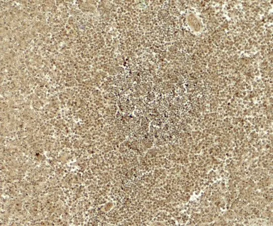 IHC-P analysis of human spleen tissue using GTX31942 ATG4B antibody. Working concentration : 5 microg/ml IHC-P analysis of human spleen tissue using GTX31942 ATG4B antibody. Working concentration : 5 microg/ml