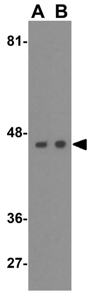 WB analysis of (A) Ramos and (B) Jurkat cell lysate using GTX31942 ATG4B antibody. Working concentration : 1 microg/ml