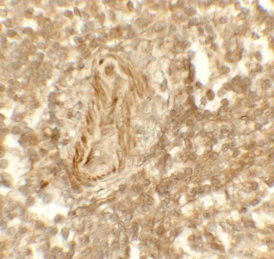IHC-P analysis of human spleen tissue using GTX31950 LSD1 antibody. Working concentration : 5 microg/ml IHC-P analysis of human spleen tissue using GTX31950 LSD1 antibody. Working concentration : 5 microg/ml