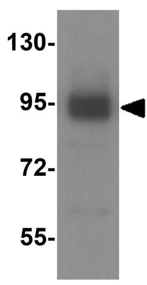 WB analysis of A549 cell lysate using GTX31950 LSD1 antibody. Working concentration : 1 microg/ml