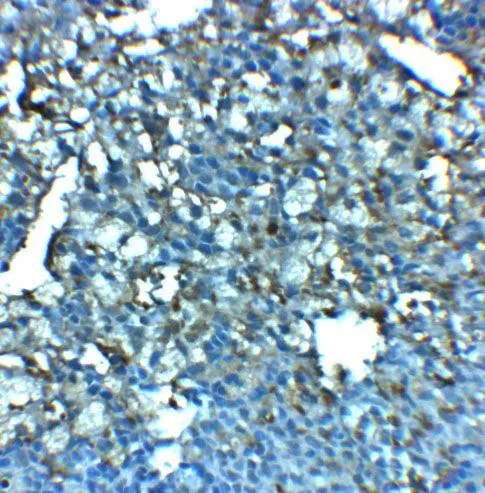 IHC-P analysis of rat spleen tissue using GTX31953 LRRC8A antibody. Working concentration : 2.5 microg/ml IHC-P analysis of rat spleen tissue using GTX31953 LRRC8A antibody. Working concentration : 2.5 microg/ml