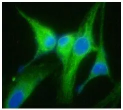 ICC/IF analysis of GRP94 in U87MG cells line, stained with DAPI (Blue) for nucleus staining and monoclonal anti-human GRP94 antibody (1:100) with goat anti-mouse IgG-Alexa fluor 488 conjugate (Green). ICC/IF analysis of GRP94 in U87MG cells line, stained with DAPI (Blue) for nucleus staining and monoclonal anti-human GRP94 antibody (1:100) with goat anti-mouse IgG-Alexa fluor 488 conjugate (Green).