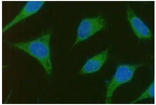 ICC/IF analysis of TBCEL in PC3 cells line, stained with DAPI (Blue) for nucleus staining and monoclonal anti-human TBCEL antibody (1:100) with goat anti-mouse IgG-Alexa fluor 488 conjugate (Green). ICC/IF analysis of TBCEL in PC3 cells line, stained with DAPI (Blue) for nucleus staining and monoclonal anti-human TBCEL antibody (1:100) with goat anti-mouse IgG-Alexa fluor 488 conjugate (Green).