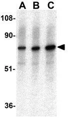WB analysis of K562 cell lysate using GTX31962 CNKSR1 antibody. Working concentration : (A) 0.5, (B) 1, and (C) 2 microg/ml WB analysis of K562 cell lysate using GTX31962 CNKSR1 antibody. Working concentration : (A) 0.5, (B) 1, and (C) 2 microg/ml