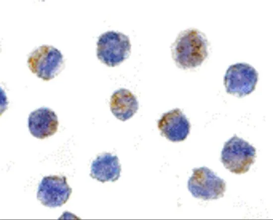 ICC/IF analysis of K562 cells using GTX31962 CNKSR1 antibody. Working concentration : 5 microg/ml