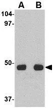 WB analysis of HeLa cell lysate using GTX31964 UNC93A antibody. Working concentration : (A) 0.5 and (B) 1 microg/ml WB analysis of HeLa cell lysate using GTX31964 UNC93A antibody. Working concentration : (A) 0.5 and (B) 1 microg/ml