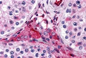 IHC-P analysis of human testis tissue using GTX31967 PTCHD2 antibody. Working concentration : 5 microg/ml IHC-P analysis of human testis tissue using GTX31967 PTCHD2 antibody. Working concentration : 5 microg/ml