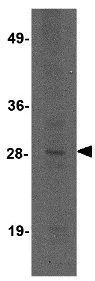 WB analysis of mouse brain tissue lysate using GTX31969 KLRA3 antibody. Working concentration : 2 microg/ml WB analysis of mouse brain tissue lysate using GTX31969 KLRA3 antibody. Working concentration : 2 microg/ml