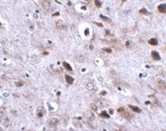 IHC-P analysis of mouse brain tissue using GTX31972 TMEM18 antibody. Working concentration : 2.5 microg/ml IHC-P analysis of mouse brain tissue using GTX31972 TMEM18 antibody. Working concentration : 2.5 microg/ml