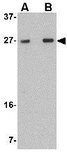WB analysis of rat brain tissue lysate using GTX31972 TMEM18 antibody. Working concentration : (A) 0.5 and (B) 1 microg/ml