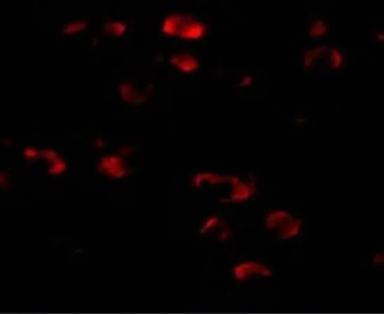 IHC-P analysis of mouse brain tissue using GTX31972 TMEM18 antibody. Working concentration : 20 microg/ml
