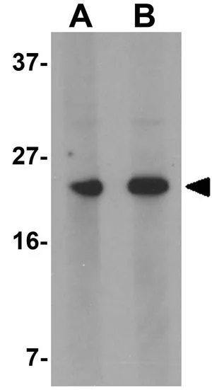 WB analysis of mouse heart tissue lysate using GTX31975 MARVELD1 antibody. Working concentration : (A) 1 and (B) 2 microg/ml WB analysis of mouse heart tissue lysate using GTX31975 MARVELD1 antibody. Working concentration : (A) 1 and (B) 2 microg/ml