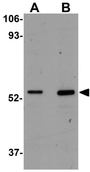 WB analysis of mouse heart tissue lysate using GTX31976 CCDC47 antibody. Working concentration : (A) 1 and (B) 2 microg/ml