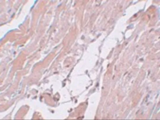 IHC-P analysis of mouse heart tissue using GTX31977 CCDC47 antibody. Working concentration : 5 microg/ml IHC-P analysis of mouse heart tissue using GTX31977 CCDC47 antibody. Working concentration : 5 microg/ml