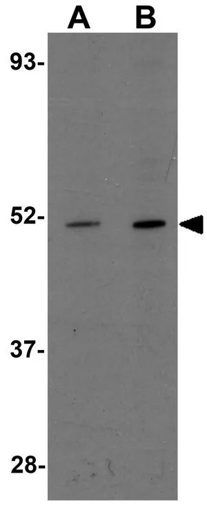 WB analysis of mouse heart tissue lysate using GTX31977 CCDC47 antibody. Working concentration : (A) 1 and (B) 2 microg/ml