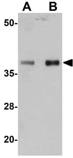 WB analysis of mouse heart tissue lysate using GTX31978 PPAPDC3 antibody. Working concentration : (A) 1 and (B) 2 microg/ml
