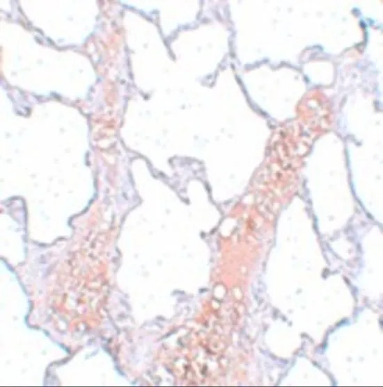 IHC-P analysis of rat lung tissue using GTX31981 REEP2 antibody. Working concentration : 5 microg/ml IHC-P analysis of rat lung tissue using GTX31981 REEP2 antibody. Working concentration : 5 microg/ml
