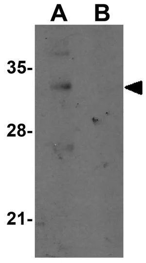 WB analysis of mouse lung tissue lysate in (A) the absence and (B) the presence of blocking peptide using GTX31981 REEP2 antibody. Working concentration : 1 microg/ml