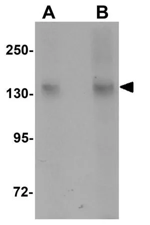 WB analysis of 3T3 cell lysate using GTX31989 NLRC3 antibody. Working concentration : (A) 1 and (B) 2 microg/ml WB analysis of 3T3 cell lysate using GTX31989 NLRC3 antibody. Working concentration : (A) 1 and (B) 2 microg/ml