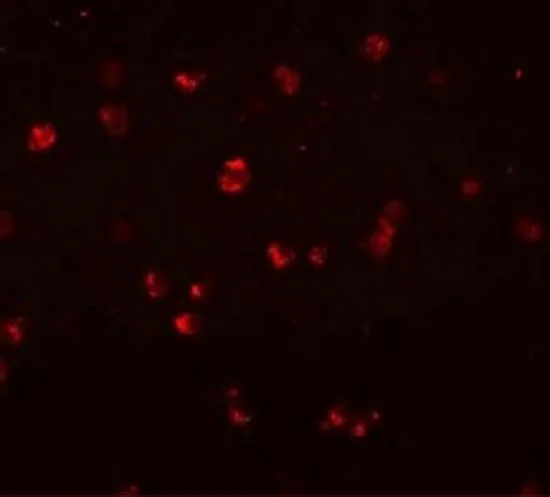 ICC/IF analysis of Jurkat cells using GTX31989 NLRC3 antibody. Working concentration : 20 microg/ml