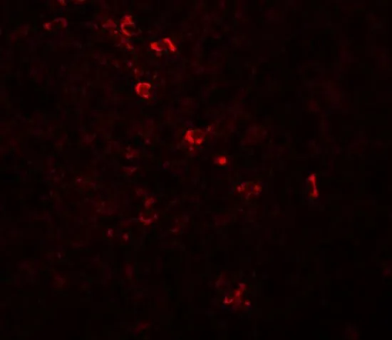 IHC-P analysis of human spleen tissue using GTX31999 ZBTB8 antibody. Working concentration : 20 microg/ml