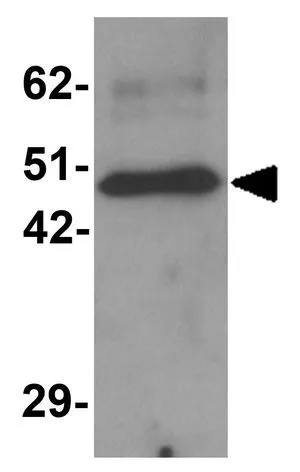 WB analysis of mouse spleen tissue lysate using GTX31999 ZBTB8 antibody. Working concentration : 1 microg/ml
