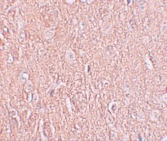 IHC-P analysis of human brain tissue using GTX32002 LRRTM2 antibody. Working concentration : 2.5 microg/ml IHC-P analysis of human brain tissue using GTX32002 LRRTM2 antibody. Working concentration : 2.5 microg/ml
