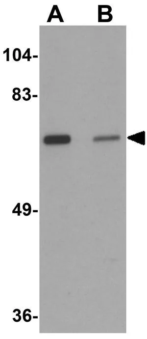 WB analysis of SK-N-SH cell lysate in (A) the absence and (B) the presence of blocking peptide using GTX32002 LRRTM2 antibody. Working concentration : 1 microg/ml