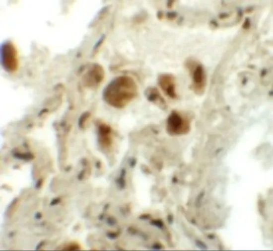 IHC-P analysis of human lung tissue using GTX32014 RASSF10 antibody. Working concentration : 5 microg/ml IHC-P analysis of human lung tissue using GTX32014 RASSF10 antibody. Working concentration : 5 microg/ml